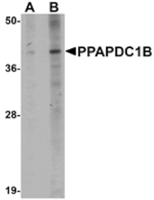 Western blot - PPAPDC1B Antibody from Signalway Antibody (25015) - Antibodies.com