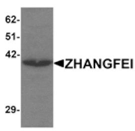 Western blot - ZHANGFEI Antibody from Signalway Antibody (25267) - Antibodies.com