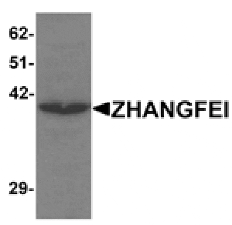 Western blot - ZHANGFEI Antibody from Signalway Antibody (25267) - Antibodies.com