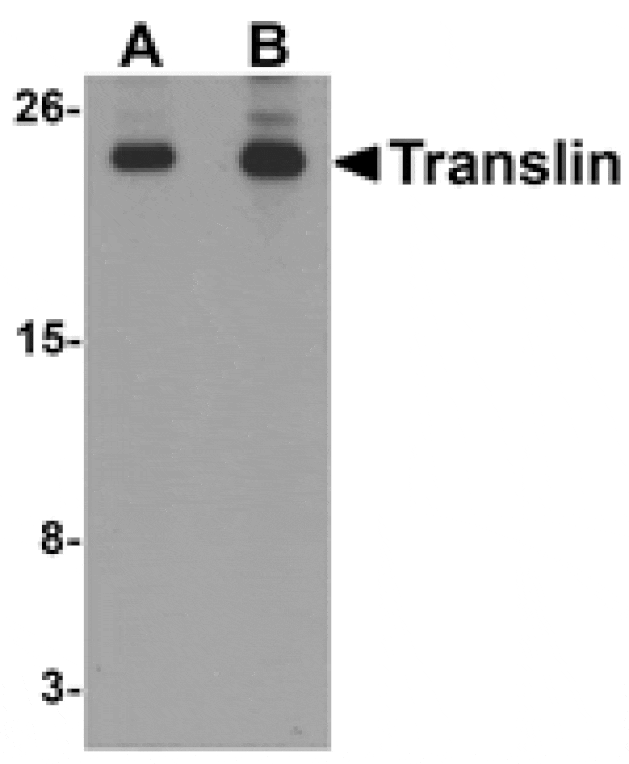 Western blot - Translin Antibody from Signalway Antibody (25312) - Antibodies.com