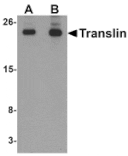 Western blot - Translin Antibody from Signalway Antibody (25312) - Antibodies.com