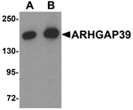 Western blot analysis of ARHGAP39 in A20 cell lysate with ARHGAP39 antibody at (A) 1 and (B) 2 µg/mL