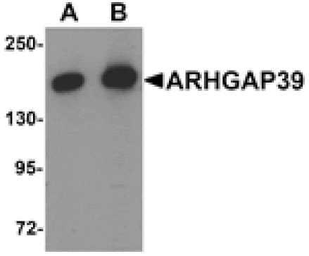 Western blot - ARHGAP39 Antibody from Signalway Antibody (25342) - Antibodies.com