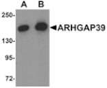 Western blot - ARHGAP39 Antibody from Signalway Antibody (25342) - Antibodies.com