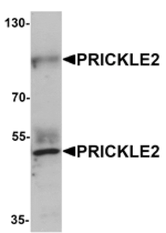 Western blot - PRICKLE2 Antibody from Signalway Antibody (25383) - Antibodies.com