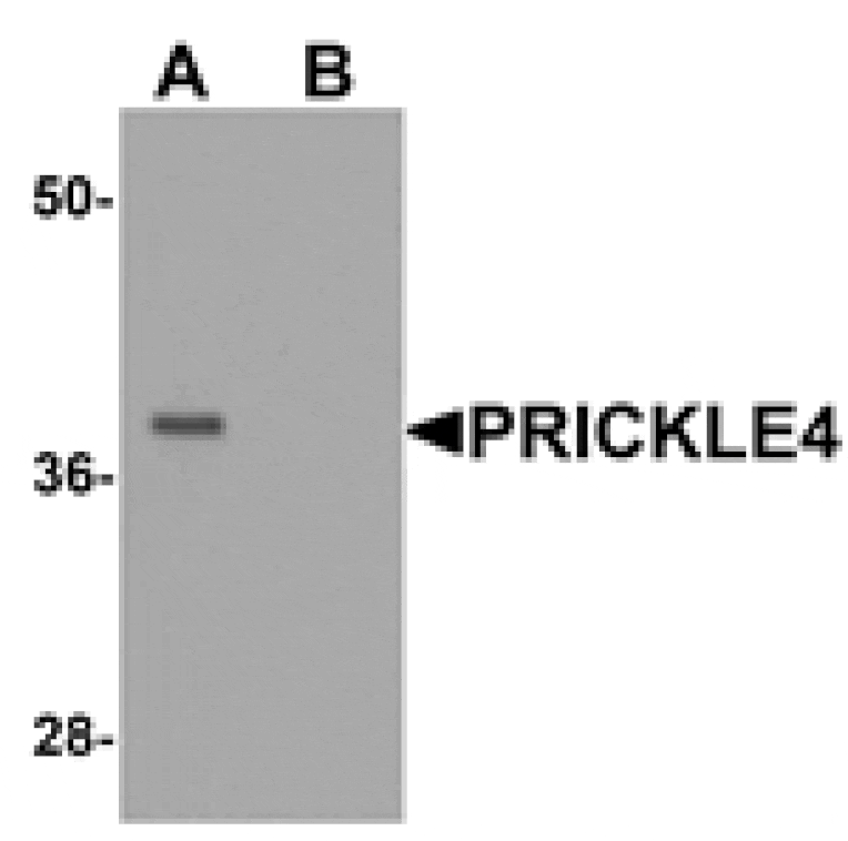Western blot - PRICKLE4 Antibody from Signalway Antibody (25384) - Antibodies.com