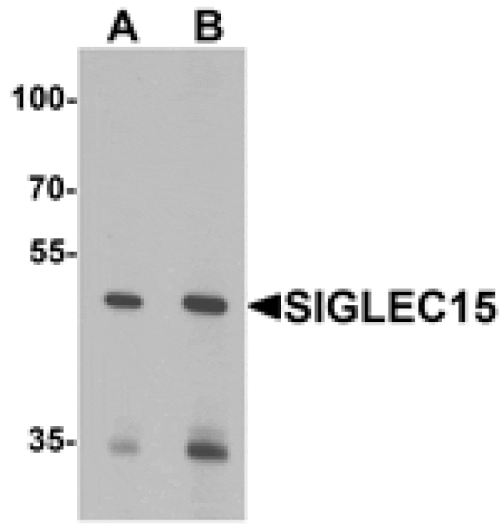 Western blot - SIGLEC15 Antibody from Signalway Antibody (25434) - Antibodies.com
