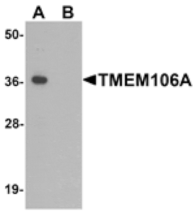 Western blot - TMEM106A Antibody from Signalway Antibody (25467) - Antibodies.com