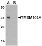 Western blot - TMEM106A Antibody from Signalway Antibody (25467) - Antibodies.com