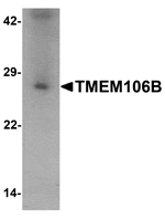 Western blot analysis of TMEM106B in human liver tissue lysate with TMEM106B antibody at 1 µg/mL.
