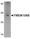 Western blot - TMEM106B Antibody from Signalway Antibody (25468) - Antibodies.com