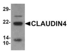 Western blot - CLAUDIN4 Antibody from Signalway Antibody (25538) - Antibodies.com