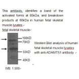 ADAMTS-1 Antibody from Signalway Antibody (39210) - Antibodies.com