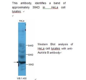 Aurora B Antibody from Signalway Antibody (39233) - Antibodies.com