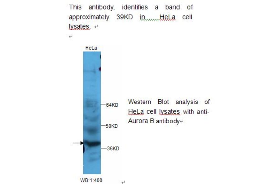 Aurora B Antibody from Signalway Antibody (39233) - Antibodies.com