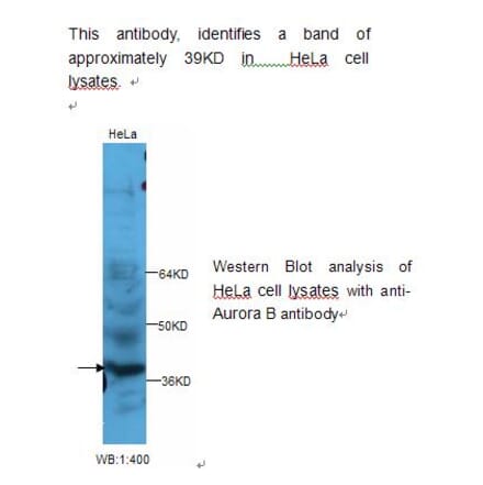 Aurora B Antibody from Signalway Antibody (39233) - Antibodies.com