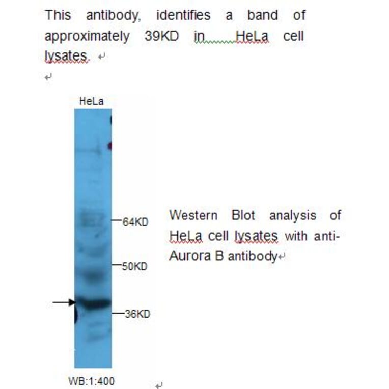 Aurora B Antibody from Signalway Antibody (39233) - Antibodies.com