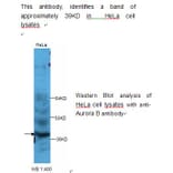 Aurora B Antibody from Signalway Antibody (39233) - Antibodies.com