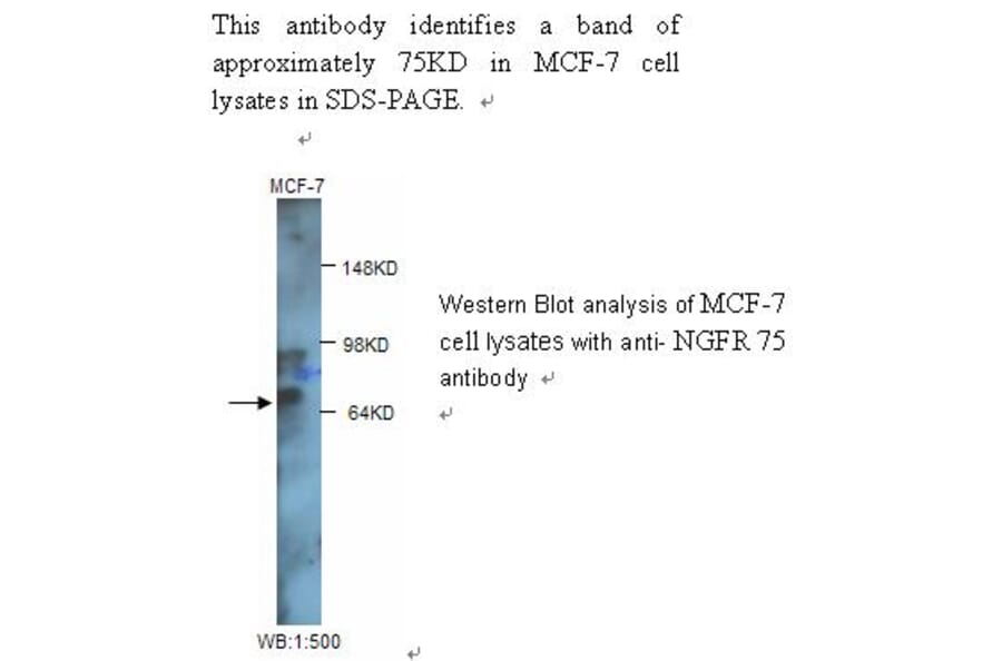 NGFR p75 Antibody from Signalway Antibody (39244) - Antibodies.com