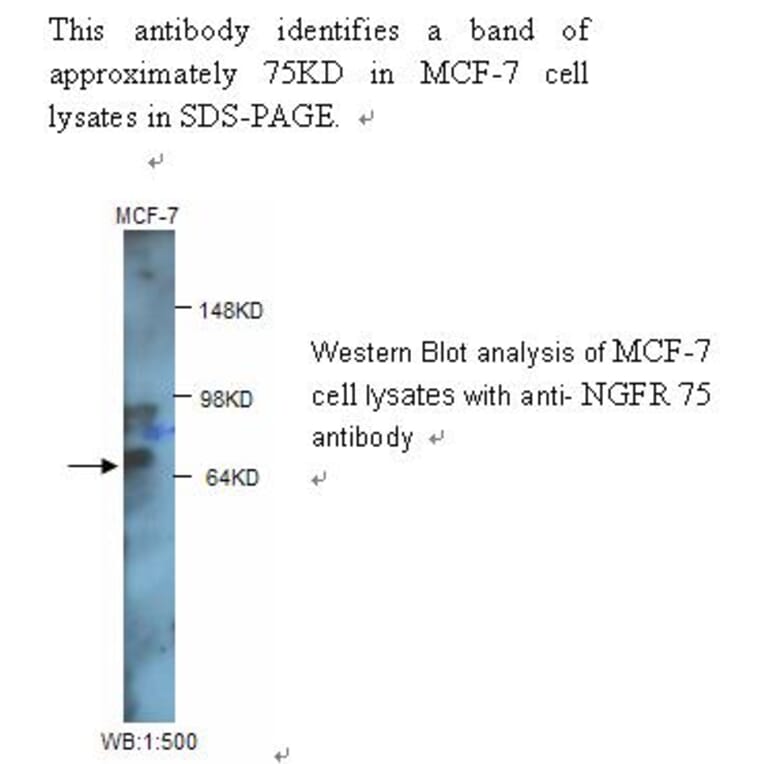 NGFR p75 Antibody from Signalway Antibody (39244) - Antibodies.com