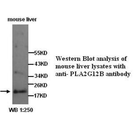 PLA2G12B Antibody from Signalway Antibody (39285) - Antibodies.com