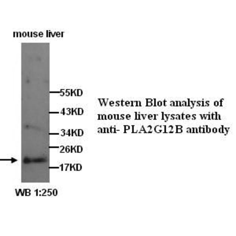 PLA2G12B Antibody from Signalway Antibody (39285) - Antibodies.com