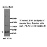 PLA2G12B Antibody from Signalway Antibody (39285) - Antibodies.com