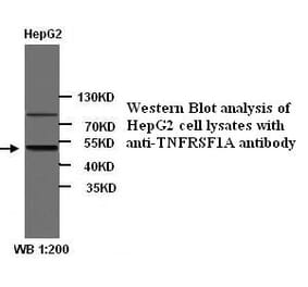 TNFRSF1A Antibody from Signalway Antibody (39293) - Antibodies.com