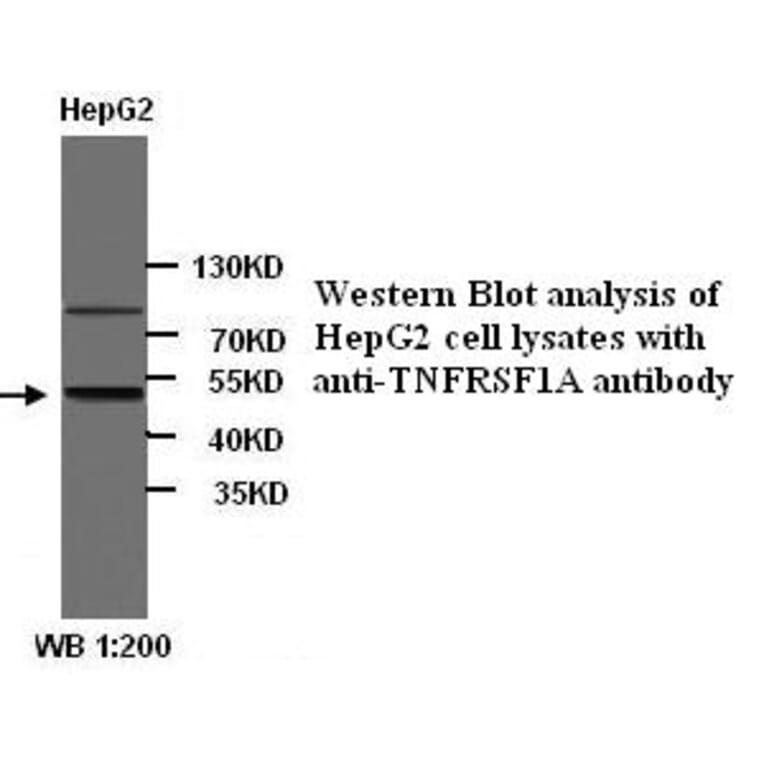 TNFRSF1A Antibody from Signalway Antibody (39293) - Antibodies.com
