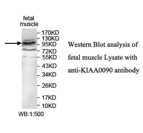 KIAA0090 Antibody from Signalway Antibody (39744) - Antibodies.com