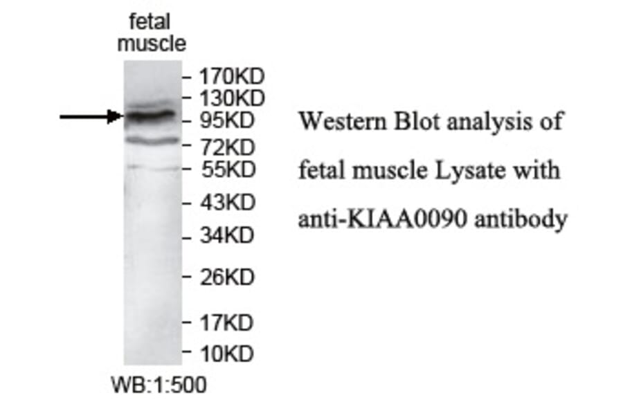 KIAA0090 Antibody from Signalway Antibody (39744) - Antibodies.com