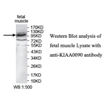 KIAA0090 Antibody from Signalway Antibody (39744) - Antibodies.com