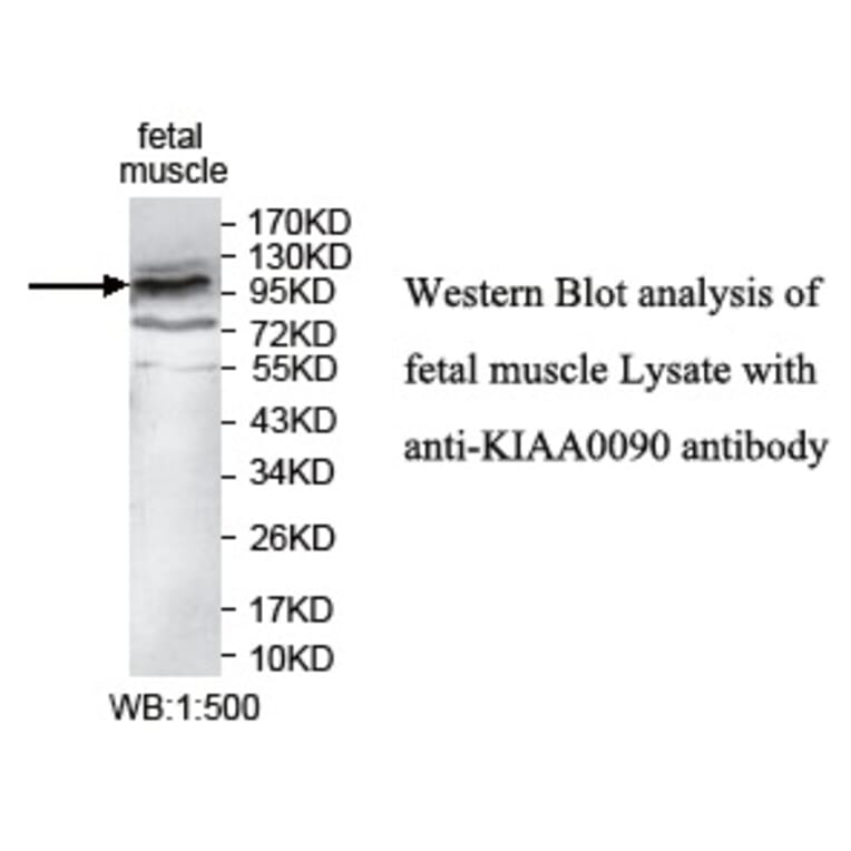 KIAA0090 Antibody from Signalway Antibody (39744) - Antibodies.com