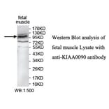 KIAA0090 Antibody from Signalway Antibody (39744) - Antibodies.com