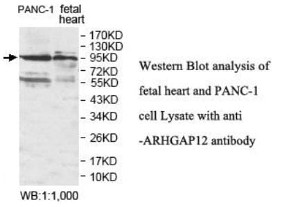 Anti-ARHGAP12 Antibody