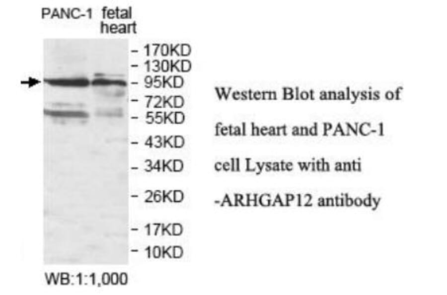 ARHGAP12 Antibody from Signalway Antibody (39930) - Antibodies.com