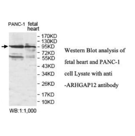 ARHGAP12 Antibody from Signalway Antibody (39930) - Antibodies.com