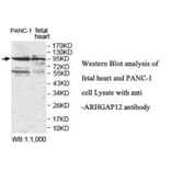 ARHGAP12 Antibody from Signalway Antibody (39930) - Antibodies.com