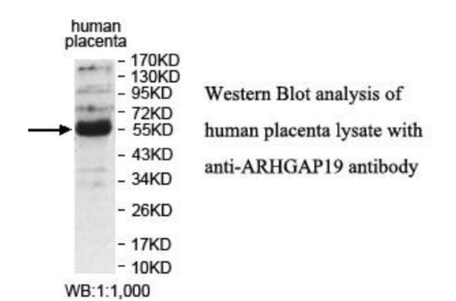 ARHGAP19 Antibody from Signalway Antibody (39931) - Antibodies.com