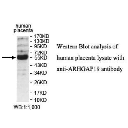 ARHGAP19 Antibody from Signalway Antibody (39931) - Antibodies.com