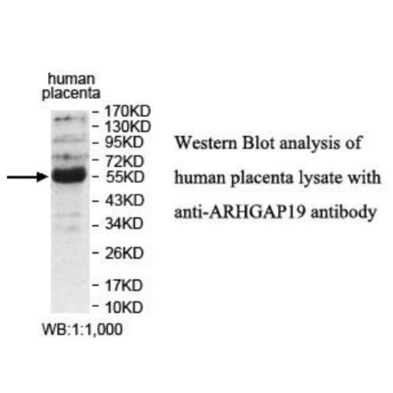 ARHGAP19 Antibody from Signalway Antibody (39931) - Antibodies.com
