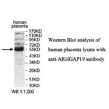 ARHGAP19 Antibody from Signalway Antibody (39931) - Antibodies.com