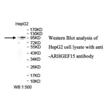 ARHGEF15 Antibody from Signalway Antibody (39932) - Antibodies.com