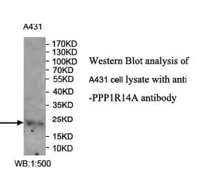 PPP1R14A Antibody from Signalway Antibody (39990) - Antibodies.com