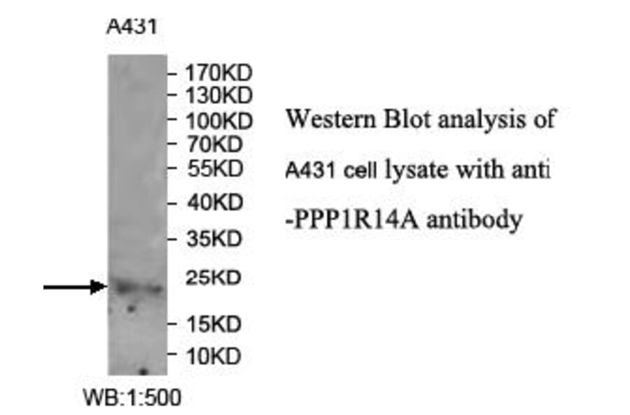PPP1R14A Antibody from Signalway Antibody (39990) - Antibodies.com