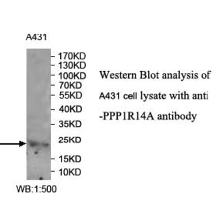 PPP1R14A Antibody from Signalway Antibody (39990) - Antibodies.com