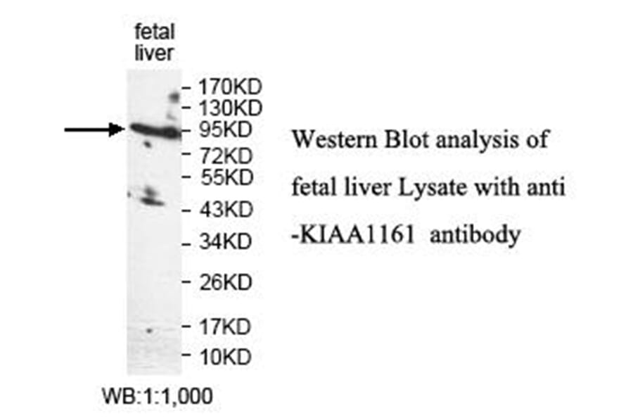 KIAA1161 Antibody from Signalway Antibody (40018) - Antibodies.com