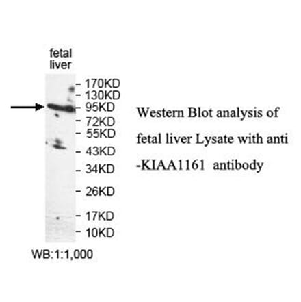 KIAA1161 Antibody from Signalway Antibody (40018) - Antibodies.com