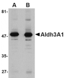 Western blot - Aldh3A1 Antibody from Signalway Antibody (24749) - Antibodies.com