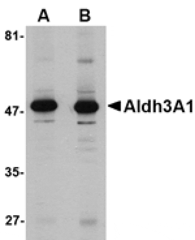 Western blot - Aldh3A1 Antibody from Signalway Antibody (24749) - Antibodies.com